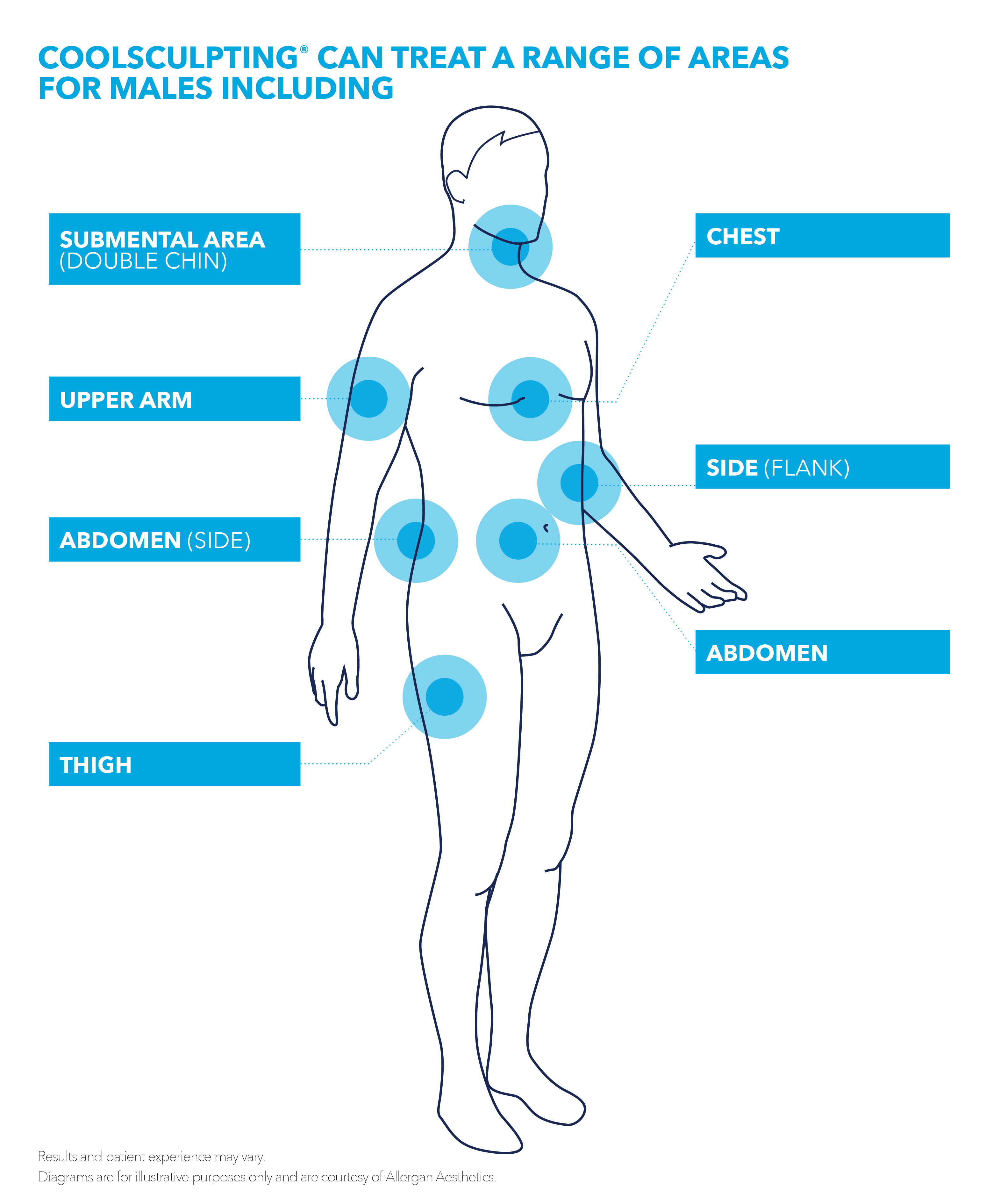 CoolSculpting® can treat a range of areas of males